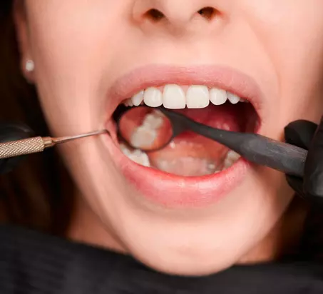 Dentista olhando os dentes do paciente