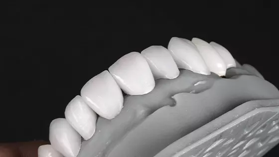 imagem 3D de dente 