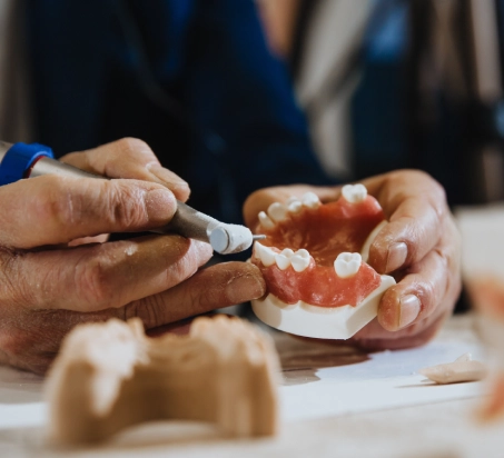 Imagem de uma prótese dentária