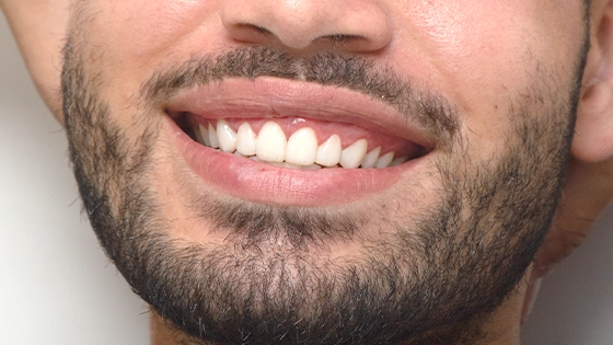 homem sorrindo 
